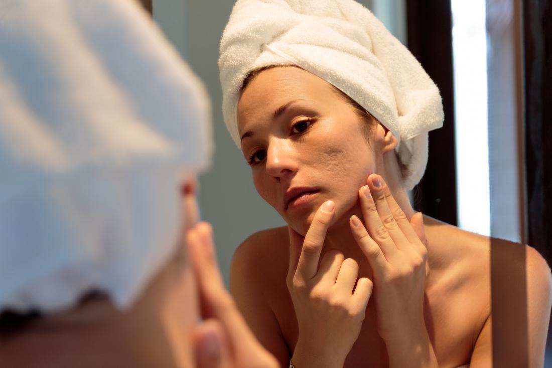 Kako izboljšati teksturo kože (svetuje dermatologinja)