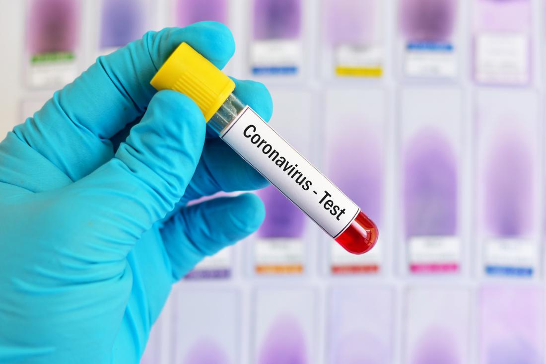 Zakaj koronavirus najbolj ogroža kadilce